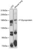 Western blot analysis of extracts of various cell lines, using P Glycoprotein antibody (14-654) at 1:1000 dilution.<br/>Secondary antibody: HRP Goat Anti-Rabbit IgG (H+L) at 1:10000 dilution.<br/>Lysates/proteins: 25ug per lane.<br/>Blocking buffer: 3% nonfat dry milk in TBST.<br/>Detection: ECL Enhanced Kit.<br/>Exposure time: 30s.
