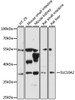 Western blot analysis of extracts of various cell lines, using SLC10A2 antibody (14-658) at 1:3000 dilution.<br/>Secondary antibody: HRP Goat Anti-Rabbit IgG (H+L) at 1:10000 dilution.<br/>Lysates/proteins: 25ug per lane.<br/>Blocking buffer: 3% nonfat dry milk in TBST.<br/>Detection: ECL Basic Kit.<br/>Exposure time: 30s.