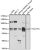 Western blot analysis of extracts of various cell lines, using SLC27A1 antibody (14-659) at 1:3000 dilution.<br/>Secondary antibody: HRP Goat Anti-Rabbit IgG (H+L) at 1:10000 dilution.<br/>Lysates/proteins: 25ug per lane.<br/>Blocking buffer: 3% nonfat dry milk in TBST.<br/>Detection: ECL Enhanced Kit.<br/>Exposure time: 30s.