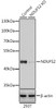 Western blot analysis of extracts from normal (control) and NDUFS2 knockout (KO) 293T cells, using NDUFS2 antibody (14-668) at 1:3000 dilution.<br/>Secondary antibody: HRP Goat Anti-Rabbit IgG (H+L) at 1:10000 dilution.<br/>Lysates/proteins: 25ug per lane.<br/>Blocking buffer: 3% nonfat dry milk in TBST.<br/>Detection: ECL Basic Kit.<br/>Exposure time: 15s.
