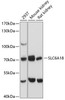 Western blot analysis of extracts of various cell lines, using SLC6A18 antibody (14-669) at 1:3000 dilution.<br/>Secondary antibody: HRP Goat Anti-Rabbit IgG (H+L) at 1:10000 dilution.<br/>Lysates/proteins: 25ug per lane.<br/>Blocking buffer: 3% nonfat dry milk in TBST.<br/>Detection: ECL Basic Kit.<br/>Exposure time: 30s.