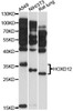 Western blot analysis of extracts of various cell lines, using HOXD12 antibody (14-677) at 1:3000 dilution.<br/>Secondary antibody: HRP Goat Anti-Rabbit IgG (H+L) at 1:10000 dilution.<br/>Lysates/proteins: 25ug per lane.<br/>Blocking buffer: 3% nonfat dry milk in TBST.<br/>Detection: ECL Basic Kit.<br/>Exposure time: 60s.