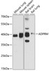 Western blot analysis of extracts of various cell lines, using ADPRM antibody (14-682) at 1:3000 dilution.<br/>Secondary antibody: HRP Goat Anti-Rabbit IgG (H+L) at 1:10000 dilution.<br/>Lysates/proteins: 25ug per lane.<br/>Blocking buffer: 3% nonfat dry milk in TBST.<br/>Detection: ECL Basic Kit.<br/>Exposure time: 10s.