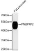 Western blot analysis of extracts of rat pancreas, using PNLIPRP2 antibody (14-689) at 1:3000 dilution.<br/>Secondary antibody: HRP Goat Anti-Rabbit IgG (H+L) at 1:10000 dilution.<br/>Lysates/proteins: 25ug per lane.<br/>Blocking buffer: 3% nonfat dry milk in TBST.<br/>Detection: ECL Enhanced Kit.<br/>Exposure time: 90s.