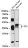 Western blot analysis of extracts of various cell lines, using SDS antibody (14-690) at 1:3000 dilution.<br/>Secondary antibody: HRP Goat Anti-Rabbit IgG (H+L) at 1:10000 dilution.<br/>Lysates/proteins: 25ug per lane.<br/>Blocking buffer: 3% nonfat dry milk in TBST.<br/>Detection: ECL Enhanced Kit.<br/>Exposure time: 30s.