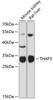 Western blot analysis of extracts of various cell lines, using THAP3 antibody (14-691) at 1:3000 dilution.<br/>Secondary antibody: HRP Goat Anti-Rabbit IgG (H+L) at 1:10000 dilution.<br/>Lysates/proteins: 25ug per lane.<br/>Blocking buffer: 3% nonfat dry milk in TBST.<br/>Detection: ECL Basic Kit.<br/>Exposure time: 90s.