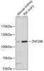 Western blot analysis of extracts of various cell lines, using ZNF268 antibody (14-693) at 1:3000 dilution.<br/>Secondary antibody: HRP Goat Anti-Rabbit IgG (H+L) at 1:10000 dilution.<br/>Lysates/proteins: 25ug per lane.<br/>Blocking buffer: 3% nonfat dry milk in TBST.<br/>Detection: ECL Basic Kit.<br/>Exposure time: 10s.
