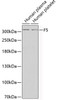 Western blot analysis of extracts of various cell lines, using F5 antibody (14-699) .