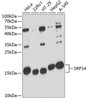 Western blot analysis of extracts of various cell lines, using SRP14 antibody (14-703) at 1:3000 dilution.<br/>Secondary antibody: HRP Goat Anti-Rabbit IgG (H+L) at 1:10000 dilution.<br/>Lysates/proteins: 25ug per lane.<br/>Blocking buffer: 3% nonfat dry milk in TBST.<br/>Detection: ECL Basic Kit.<br/>Exposure time: 90s.