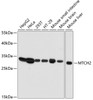 Western blot analysis of extracts of various cell lines, using MTCH2 antibody (14-706) at 1:3000 dilution.<br/>Secondary antibody: HRP Goat Anti-Rabbit IgG (H+L) at 1:10000 dilution.<br/>Lysates/proteins: 25ug per lane.<br/>Blocking buffer: 3% nonfat dry milk in TBST.<br/>Detection: ECL Basic Kit.<br/>Exposure time: 30s.