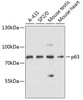 Western blot analysis of extracts of various cell lines, using p63 antibody (14-707) at 1:3000 dilution.<br/>Secondary antibody: HRP Goat Anti-Rabbit IgG (H+L) at 1:10000 dilution.<br/>Lysates/proteins: 25ug per lane.<br/>Blocking buffer: 3% nonfat dry milk in TBST.<br/>Detection: ECL Basic Kit.<br/>Exposure time: 10s.