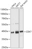 Western blot analysis of extracts of various cell lines, using CDK7 antibody (14-712) at 1:1000 dilution.<br/>Secondary antibody: HRP Goat Anti-Rabbit IgG (H+L) at 1:10000 dilution.<br/>Lysates/proteins: 25ug per lane.<br/>Blocking buffer: 3% nonfat dry milk in TBST.<br/>Detection: ECL Basic Kit.<br/>Exposure time: 15s.