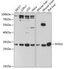 Western blot analysis of extracts of various cell lines, using SFXN1 antibody (14-723) at 1:3000 dilution.<br/>Secondary antibody: HRP Goat Anti-Rabbit IgG (H+L) at 1:10000 dilution.<br/>Lysates/proteins: 25ug per lane.<br/>Blocking buffer: 3% nonfat dry milk in TBST.<br/>Detection: ECL Basic Kit.<br/>Exposure time: 90s.