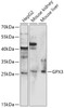 Western blot analysis of extracts of various cell lines, using GPX3 antibody (14-724) at 1:1000 dilution.<br/>Secondary antibody: HRP Goat Anti-Rabbit IgG (H+L) at 1:10000 dilution.<br/>Lysates/proteins: 25ug per lane.<br/>Blocking buffer: 3% nonfat dry milk in TBST.<br/>Detection: ECL Basic Kit.<br/>Exposure time: 90s.