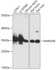 Western blot analysis of extracts of various cell lines, using MARCH8 antibody (14-725) at 1:1000 dilution.<br/>Secondary antibody: HRP Goat Anti-Rabbit IgG (H+L) at 1:10000 dilution.<br/>Lysates/proteins: 25ug per lane.<br/>Blocking buffer: 3% nonfat dry milk in TBST.<br/>Detection: ECL Basic Kit.<br/>Exposure time: 60s.