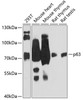 Western blot analysis of extracts of various cell lines, using p63 antibody (14-729) at 1:3000 dilution.<br/>Secondary antibody: HRP Goat Anti-Rabbit IgG (H+L) at 1:10000 dilution.<br/>Lysates/proteins: 25ug per lane.<br/>Blocking buffer: 3% nonfat dry milk in TBST.<br/>Detection: ECL Basic Kit.<br/>Exposure time: 30s.
