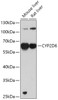 Western blot analysis of extracts of various cell lines, using CYP2D6 antibody (14-731) at 1:1000 dilution.<br/>Secondary antibody: HRP Goat Anti-Rabbit IgG (H+L) at 1:10000 dilution.<br/>Lysates/proteins: 25ug per lane.<br/>Blocking buffer: 3% nonfat dry milk in TBST.<br/>Detection: ECL Basic Kit.<br/>Exposure time: 90s.