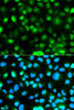 Immunofluorescence analysis of HeLa cells using Ataxin 3 antibody (14-732) . Blue: DAPI for nuclear staining.