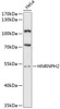 Western blot analysis of extracts of HeLa cells, using HNRNPH2 antibody (14-733) at 1:3000 dilution.<br/>Secondary antibody: HRP Goat Anti-Rabbit IgG (H+L) at 1:10000 dilution.<br/>Lysates/proteins: 25ug per lane.<br/>Blocking buffer: 3% nonfat dry milk in TBST.<br/>Detection: ECL Basic Kit.<br/>Exposure time: 90s.