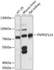 Western blot analysis of extracts of various cell lines, using TNFRSF11A antibody (14-735) at 1:3000 dilution.<br/>Secondary antibody: HRP Goat Anti-Rabbit IgG (H+L) at 1:10000 dilution.<br/>Lysates/proteins: 25ug per lane.<br/>Blocking buffer: 3% nonfat dry milk in TBST.<br/>Detection: ECL Basic Kit.<br/>Exposure time: 30s.