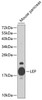 Western blot analysis of extracts of mouse pancreas, using LEP antibody (14-737) at 1:1000 dilution.<br/>Secondary antibody: HRP Goat Anti-Rabbit IgG (H+L) at 1:10000 dilution.<br/>Lysates/proteins: 25ug per lane.<br/>Blocking buffer: 3% nonfat dry milk in TBST.<br/>Detection: ECL Basic Kit.<br/>Exposure time: 90s.