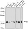 Western blot analysis of extracts of various cell lines, using RPL32 antibody (14-738) at 1:3000 dilution.<br/>Secondary antibody: HRP Goat Anti-Rabbit IgG (H+L) at 1:10000 dilution.<br/>Lysates/proteins: 25ug per lane.<br/>Blocking buffer: 3% nonfat dry milk in TBST.<br/>Detection: ECL Basic Kit.<br/>Exposure time: 1s.