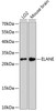 Western blot analysis of extracts of various cell lines, using ELANE antibody (14-745) at 1:3000 dilution.<br/>Secondary antibody: HRP Goat Anti-Rabbit IgG (H+L) at 1:10000 dilution.<br/>Lysates/proteins: 25ug per lane.<br/>Blocking buffer: 3% nonfat dry milk in TBST.<br/>Detection: ECL Enhanced Kit.<br/>Exposure time: 90s.