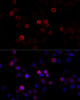 Immunofluorescence analysis of HeLa cells using FLNC antibody (14-747) at dilution of 1:100 (40x lens) . Blue: DAPI for nuclear staining.