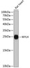 Western blot analysis of extracts of rat heart, using MYL4 antibody (14-755) at 1:3000 dilution.<br/>Secondary antibody: HRP Goat Anti-Rabbit IgG (H+L) at 1:10000 dilution.<br/>Lysates/proteins: 25ug per lane.<br/>Blocking buffer: 3% nonfat dry milk in TBST.<br/>Detection: ECL Basic Kit.<br/>Exposure time: 90s.