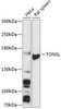 Western blot analysis of extracts of various cell lines, using TONSL antibody (14-758) at 1:3000 dilution.<br/>Secondary antibody: HRP Goat Anti-Rabbit IgG (H+L) at 1:10000 dilution.<br/>Lysates/proteins: 25ug per lane.<br/>Blocking buffer: 3% nonfat dry milk in TBST.<br/>Detection: ECL Basic Kit.<br/>Exposure time: 30s.