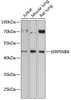 Western blot analysis of extracts of various cell lines, using SERPINB8 antibody (14-760) at 1:3000 dilution.<br/>Secondary antibody: HRP Goat Anti-Rabbit IgG (H+L) at 1:10000 dilution.<br/>Lysates/proteins: 25ug per lane.<br/>Blocking buffer: 3% nonfat dry milk in TBST.<br/>Detection: ECL Basic Kit.<br/>Exposure time: 90s.