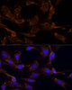 Immunofluorescence analysis of C6 cells using RPL27 Polyclonal Antibody (14-762) at dilution of 1:100 (40x lens) . Blue: DAPI for nuclear staining.
