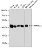 Western blot analysis of extracts of various cell lines, using MAPK12 antibody (14-764) at 1:10000 dilution.<br/>Secondary antibody: HRP Goat Anti-Rabbit IgG (H+L) at 1:10000 dilution.<br/>Lysates/proteins: 25ug per lane.<br/>Blocking buffer: 3% nonfat dry milk in TBST.<br/>Detection: ECL Basic Kit.<br/>Exposure time: 30s.