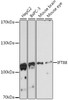 Western blot analysis of extracts of various cell lines, using IFT88 antibody (14-768) at 1:3000 dilution.<br/>Secondary antibody: HRP Goat Anti-Rabbit IgG (H+L) at 1:10000 dilution.<br/>Lysates/proteins: 25ug per lane.<br/>Blocking buffer: 3% nonfat dry milk in TBST.<br/>Detection: ECL Basic Kit.<br/>Exposure time: 90s.