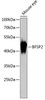 Western blot analysis of extracts of mouse eye, using BFSP2 antibody (14-769) at 1:3000 dilution.<br/>Secondary antibody: HRP Goat Anti-Rabbit IgG (H+L) at 1:10000 dilution.<br/>Lysates/proteins: 25ug per lane.<br/>Blocking buffer: 3% nonfat dry milk in TBST.<br/>Detection: ECL Basic Kit.<br/>Exposure time: 5s.