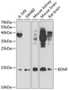 Western blot analysis of extracts of various cell lines, using BDNF antibody (14-776) at 1:1000 dilution.<br/>Secondary antibody: HRP Goat Anti-Rabbit IgG (H+L) at 1:10000 dilution.<br/>Lysates/proteins: 25ug per lane.<br/>Blocking buffer: 3% nonfat dry milk in TBST.<br/>Detection: ECL Enhanced Kit.<br/>Exposure time: 90s.