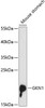 Western blot analysis of extracts of mouse stomach, using GKN1 antibody (14-797) at 1:3000 dilution.<br/>Secondary antibody: HRP Goat Anti-Rabbit IgG (H+L) at 1:10000 dilution.<br/>Lysates/proteins: 25ug per lane.<br/>Blocking buffer: 3% nonfat dry milk in TBST.<br/>Detection: ECL Basic Kit.<br/>Exposure time: 90s.