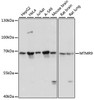 Western blot analysis of extracts of various cell lines, using MTMR9 antibody (14-803) at 1:3000 dilution.<br/>Secondary antibody: HRP Goat Anti-Rabbit IgG (H+L) at 1:10000 dilution.<br/>Lysates/proteins: 25ug per lane.<br/>Blocking buffer: 3% nonfat dry milk in TBST.<br/>Detection: ECL Basic Kit.<br/>Exposure time: 10s.