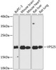 Western blot analysis of extracts of various cell lines, using VPS25 antibody (14-809) at 1:3000 dilution.<br/>Secondary antibody: HRP Goat Anti-Rabbit IgG (H+L) at 1:10000 dilution.<br/>Lysates/proteins: 25ug per lane.<br/>Blocking buffer: 3% nonfat dry milk in TBST.<br/>Detection: ECL Basic Kit.<br/>Exposure time: 30s.