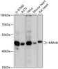 Western blot analysis of extracts of various cell lines, using PARVB antibody (14-827) at 1:3000 dilution.<br/>Secondary antibody: HRP Goat Anti-Rabbit IgG (H+L) at 1:10000 dilution.<br/>Lysates/proteins: 25ug per lane.<br/>Blocking buffer: 3% nonfat dry milk in TBST.<br/>Detection: ECL Basic Kit.<br/>Exposure time: 90s.