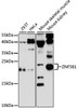 Western blot analysis of extracts of various cell lines, using ZNF581 antibody (14-828) at 1:3000 dilution.<br/>Secondary antibody: HRP Goat Anti-Rabbit IgG (H+L) at 1:10000 dilution.<br/>Lysates/proteins: 25ug per lane.<br/>Blocking buffer: 3% nonfat dry milk in TBST.<br/>Detection: ECL Enhanced Kit.<br/>Exposure time: 90s.