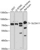 Western blot analysis of extracts of various cell lines, using SLC5A11 antibody (14-829) at 1:3000 dilution.<br/>Secondary antibody: HRP Goat Anti-Rabbit IgG (H+L) at 1:10000 dilution.<br/>Lysates/proteins: 25ug per lane.<br/>Blocking buffer: 3% nonfat dry milk in TBST.<br/>Detection: ECL Basic Kit.<br/>Exposure time: 30s.
