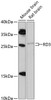 Western blot analysis of extracts of various cell lines, using RD3 antibody (14-830) at 1:1000 dilution.<br/>Secondary antibody: HRP Goat Anti-Rabbit IgG (H+L) at 1:10000 dilution.<br/>Lysates/proteins: 25ug per lane.<br/>Blocking buffer: 3% nonfat dry milk in TBST.<br/>Detection: ECL Enhanced Kit.<br/>Exposure time: 90s.