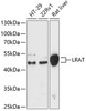 Western blot analysis of extracts of various cell lines, using Lrat antibody (14-835) at 1:3000 dilution.<br/>Secondary antibody: HRP Goat Anti-Rabbit IgG (H+L) at 1:10000 dilution.<br/>Lysates/proteins: 25ug per lane.<br/>Blocking buffer: 3% nonfat dry milk in TBST.<br/>Detection: ECL Enhanced Kit.<br/>Exposure time: 90s.