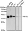 Western blot analysis of extracts of various cell lines, using RBM11 antibody (14-854) at 1:3000 dilution.<br/>Secondary antibody: HRP Goat Anti-Rabbit IgG (H+L) at 1:10000 dilution.<br/>Lysates/proteins: 25ug per lane.<br/>Blocking buffer: 3% nonfat dry milk in TBST.<br/>Detection: ECL Basic Kit.<br/>Exposure time: 90s.