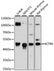 Western blot analysis of extracts of various cell lines, using ACTR6 antibody (14-860) at 1:3000 dilution.<br/>Secondary antibody: HRP Goat Anti-Rabbit IgG (H+L) at 1:10000 dilution.<br/>Lysates/proteins: 25ug per lane.<br/>Blocking buffer: 3% nonfat dry milk in TBST.<br/>Detection: ECL Basic Kit.<br/>Exposure time: 90s.