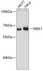 Western blot analysis of extracts of various cell lines, using SREK1 antibody (14-865) at 1:3000 dilution.<br/>Secondary antibody: HRP Goat Anti-Rabbit IgG (H+L) at 1:10000 dilution.<br/>Lysates/proteins: 25ug per lane.<br/>Blocking buffer: 3% nonfat dry milk in TBST.<br/>Detection: ECL Basic Kit.<br/>Exposure time: 90s.