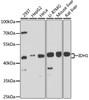 Western blot analysis of extracts of various cell lines, using IDH1 antibody (14-869) at 1:3000 dilution.<br/>Secondary antibody: HRP Goat Anti-Rabbit IgG (H+L) at 1:10000 dilution.<br/>Lysates/proteins: 25ug per lane.<br/>Blocking buffer: 3% nonfat dry milk in TBST.<br/>Detection: ECL Basic Kit.<br/>Exposure time: 30s.