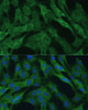 Immunofluorescence analysis of C6 cells using IDH1 Polyclonal Antibody (14-869) at dilution of 1:100 (40x lens) . Blue: DAPI for nuclear staining.