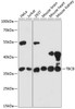 Western blot analysis of extracts of various cell lines, using TBCB antibody (14-870) at 1:3000 dilution.<br/>Secondary antibody: HRP Goat Anti-Rabbit IgG (H+L) at 1:10000 dilution.<br/>Lysates/proteins: 25ug per lane.<br/>Blocking buffer: 3% nonfat dry milk in TBST.<br/>Detection: ECL Basic Kit.<br/>Exposure time: 30s.